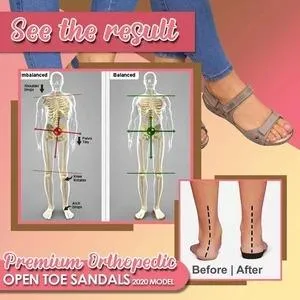 Premium orthopedic open-toed sandals